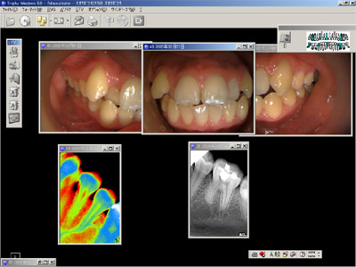 レントゲン画像