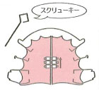 スクリューネジ